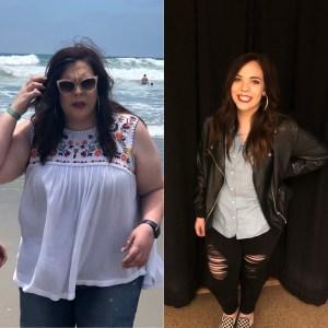 female before and after weight loss surgery.