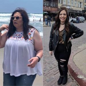 female before and after weight loss surgery 2.