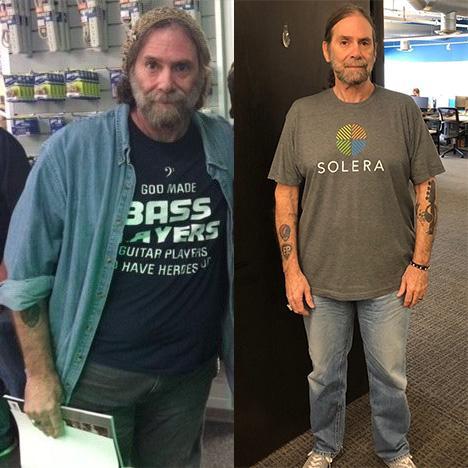 male before and after weight loss surgery.