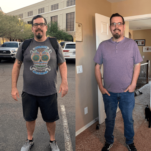 male before and after weight loss surgery 1.