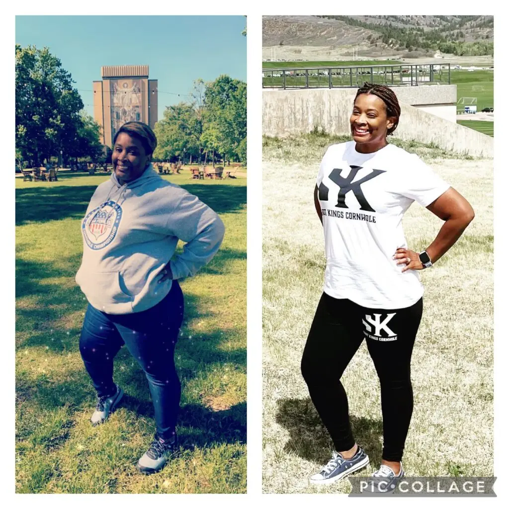 female before and after weight loss surgery 4.