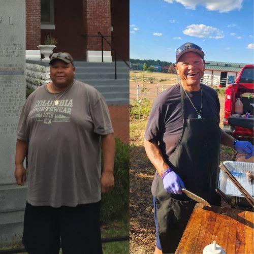 man before and after bariatric surgery.