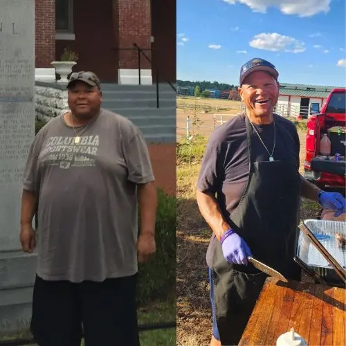 man before and after bariatric surgery.